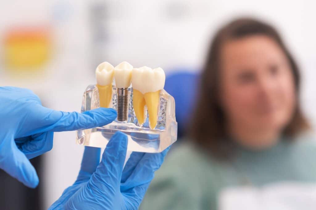 dental implants in new mexico