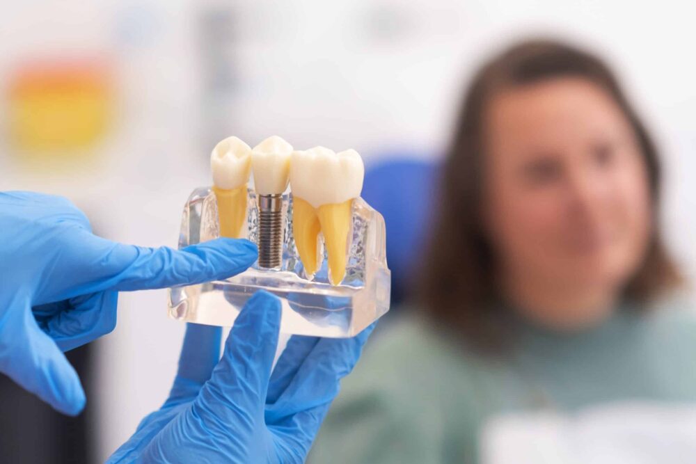 dental implants in new mexico